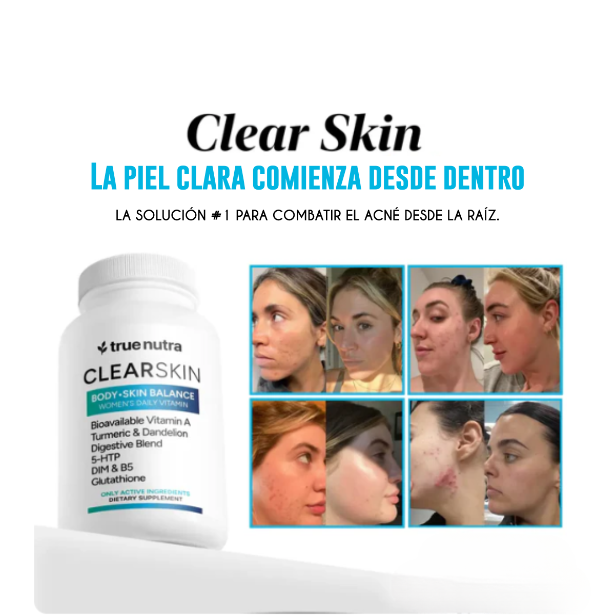 CLEARSKIN™